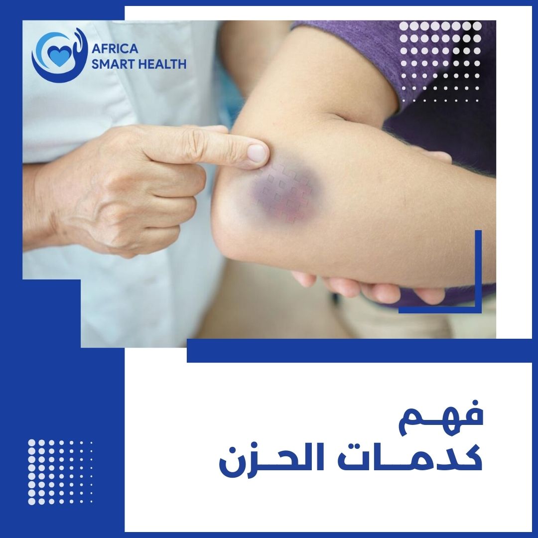 فهم كدمات الحزن