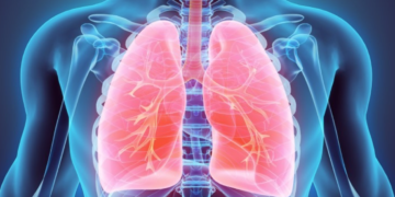 Questions Fréquentes  sur l’Hypertension Pulmonaire (HTP)