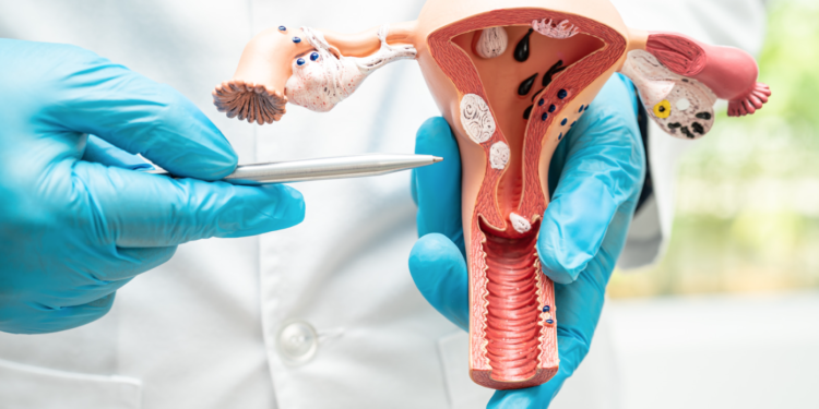 Cancer du col de l’utérus : Questions Réponses