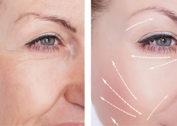 Prévenir et Atténuer les Premières Rides : Conseils Naturels et Astuces Efficaces