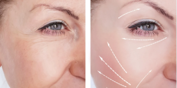 Prévenir et Atténuer les Premières Rides : Conseils Naturels et Astuces Efficaces