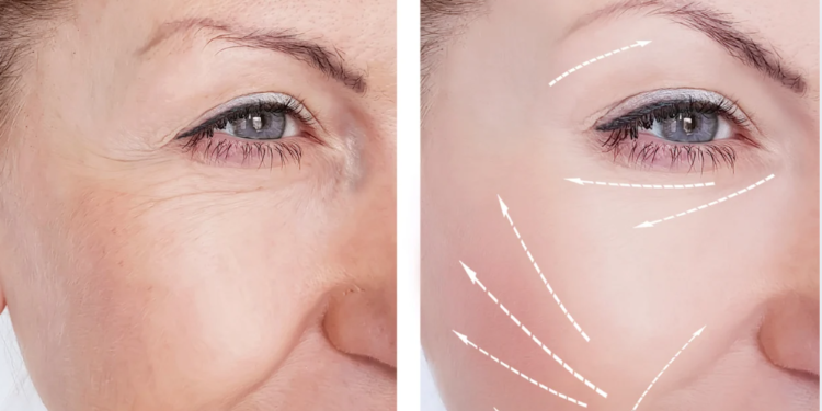 Prévenir et Atténuer les Premières Rides : Conseils Naturels et Astuces Efficaces