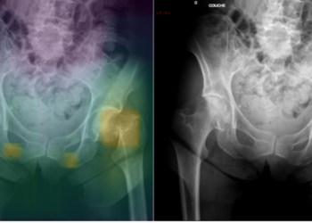 Quelle est l’offre d’intelligence artificielle en imagerie médicale au Maroc ?