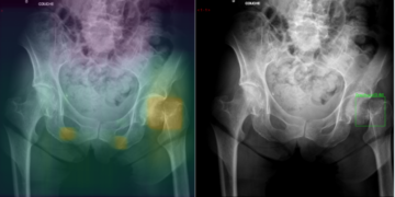 Quelle est l’offre d’intelligence artificielle en imagerie médicale au Maroc ?