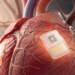 Une avancée révolutionnaire pour le traitement de l’insuffisance cardiaque